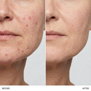 All-in-one Corrector