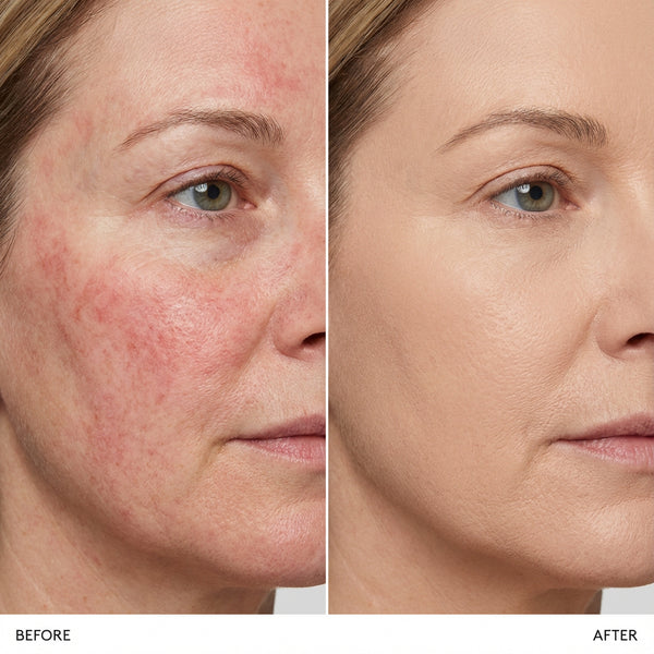 All-in-one Corrector